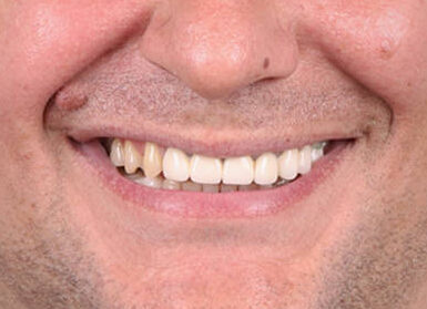 do